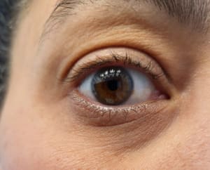 Eyeliner Tattoo result by BrowDom Brows & Beauty in Oak Brook, IL