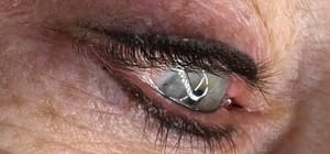 Eyeliner Tattoo result by Brows By A Bro- microblading and permanent make up training center. in Kingston, PA