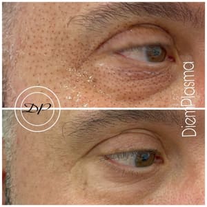 Eyeliner Tattoo result by BrowsbyDana Eyeliner SMP Sacramento Elk Grove CA in Elk Grove, CA