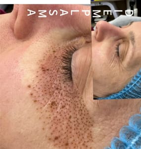 Eyeliner Tattoo result by BrowsbyDana Eyeliner SMP Sacramento Elk Grove CA in Elk Grove, CA