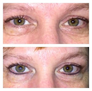 Eyeliner Tattoo result by Cariangel's Cosmetic and Medical Spa in Scarsdale, NY