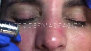 Eyeliner Tattoo result by CEN Med Spa in Miami, FL