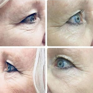 Eyeliner Tattoo result by Cosmetic Scalp & Skin Solutions LLC in Boca Raton, FL
