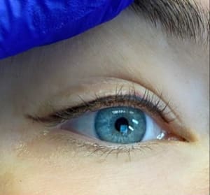 Eyeliner Tattoo result by Cosmetic Solutions in Bartlesville, OK
