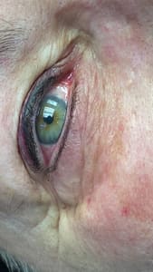 Eyeliner Tattoo result by Cosmetic Solutions in Bartlesville, OK