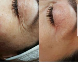 Eyeliner Tattoo result by Din Style Med Spa in Miami, FL