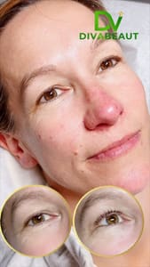 Eyeliner Tattoo result by Diva Beaut -Spa- Eyelash Extensions -Eye Brow-Head Spa-Face Lift-Hydration Skincare in Falls Church, VA