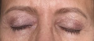 Eyeliner Tattoo result by Diva Derm Permanent Makeup Studio in Livingston, NJ