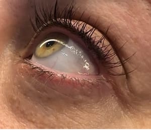 Eyeliner Tattoo result by Divine Aesthetics by Dianna Lu in Greenfield, WI