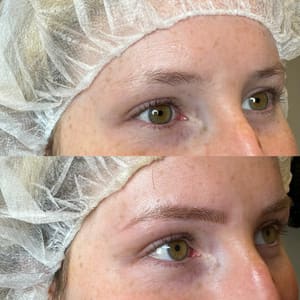 Eyeliner Tattoo result by DK Aesthetics Highland Park in Highland Park, IL