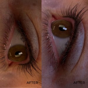Eyeliner Tattoo result by Dream Medspa in Denver, CO