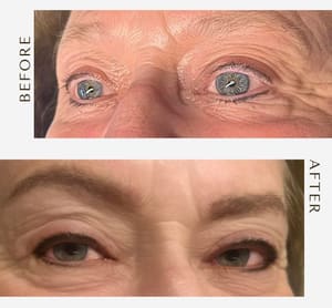 Eyeliner Tattoo result by Essence Permanent Makeup in Lynchburg, VA