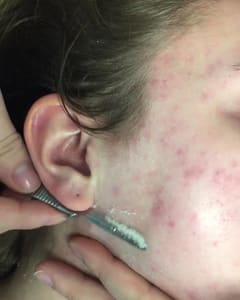 Eyeliner Tattoo result by Esthetique Medical Spa in Elko, NV