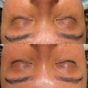 Eyeliner Tattoo result by Exquisite Skin in Grove, OK