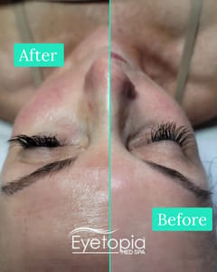 Eyeliner Tattoo result by Eyetopia Med Spa in Sandy Springs, GA