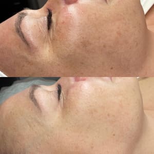 Eyeliner Tattoo result by Face First Esthetics in Boca Raton, FL