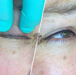 Eyeliner Tattoo result by Flawless Beauty Idaho in Meridian, ID