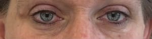 Eyeliner Tattoo result by Flawless Finish Med Spa in Cincinnati, OH