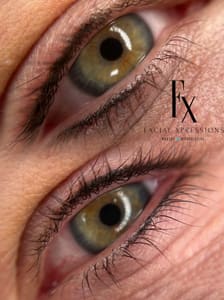 Eyeliner Tattoo result by FX Paramedical in Raleigh, NC