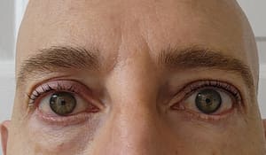 Eyeliner Tattoo result by Gc Microblading & PMU in Woodbury, NY