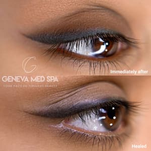 Eyeliner Tattoo result by Geneva Med Spa in Frisco, TX