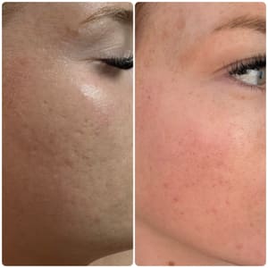 Eyeliner Tattoo result by Glowquette Esthetics in Washington, UT