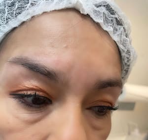 Eyeliner Tattoo result by Guinart Beauty Studios in Stuart, FL