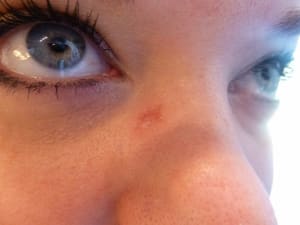 Eyeliner Tattoo result by Hair Free Skin - Dallas Electrolysis & School in Dallas, TX