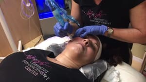 Eyeliner Tattoo result by Hope Beauty + Wellness Medspa in St Petersburg, FL