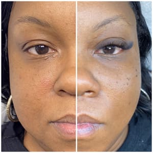 Eyeliner Tattoo result by HourGlass Body Contouring Spa in Timonium, MD