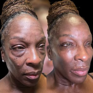 Eyeliner Tattoo result by Houston MedSpa + Wellness in Houston, TX