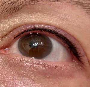 Eyeliner Tattoo result by ILLUME in Oklahoma City, OK