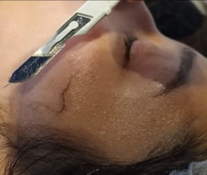 Eyeliner Tattoo result by Illustrious Therapeutics in Glendale, CO