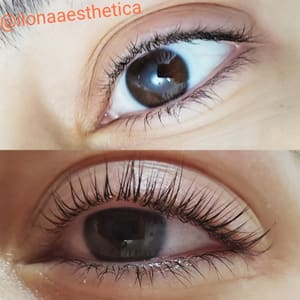 Eyeliner Tattoo result by Ilona Aesthetica in West Palm Beach, FL