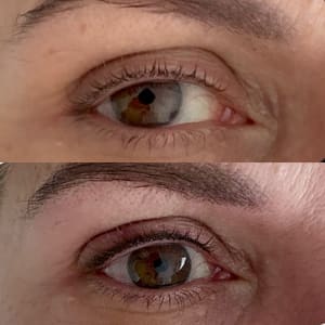 Eyeliner Tattoo result by Ilona Aesthetica in West Palm Beach, FL