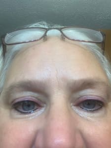 Eyeliner Tattoo result by Indiana Permanent Cosmetics in Carmel, IN