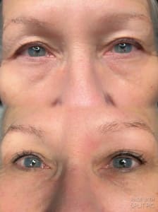 Eyeliner Tattoo result by Ink Box Beauty - Permanent Makeup and Stretch Mark Rejuvenation Spa in Aurora, CO