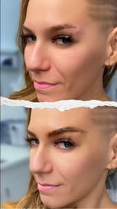 Eyeliner Tattoo result by iStar Microblading in San Marcos, CA