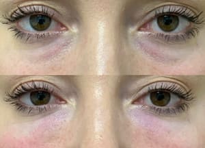 Eyeliner Tattoo result by Julia's Aesthetics in Loveland, CO