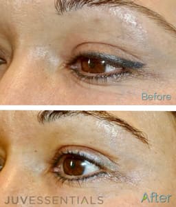 Eyeliner Tattoo result by JuvEssentials in San Francisco, CA