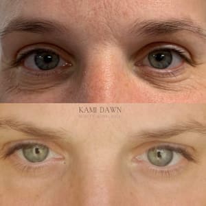 Eyeliner Tattoo result by Kami Dawn Radiance Renewed in Eagan, MN
