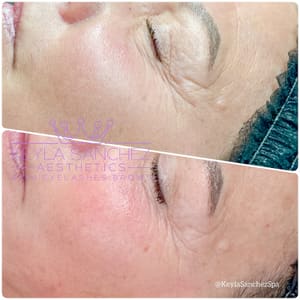Eyeliner Tattoo result by Keyla Sanchez Aesthetics in Mckinney, TX