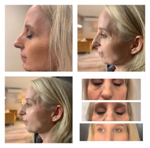 Eyeliner Tattoo result by Lake Tapps Beauty Bar & Wellness in Bonney Lake, WA