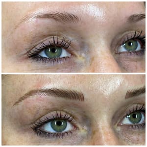 Eyeliner Tattoo result by Laser Center Of Melbourne in Melbourne, FL