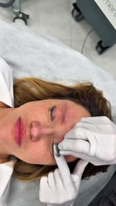 Eyeliner Tattoo result by Laserin Aesthetics in Hallandale Beach, FL