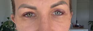 Eyeliner Tattoo result by Laserin Aesthetics in Hallandale Beach, FL