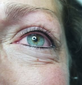 Eyeliner Tattoo result by Lasting Looks by Amanda in Fertile, MN