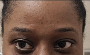 Eyeliner Tattoo result by Laturca Beauty and Skin Care in West Hollywood, CA