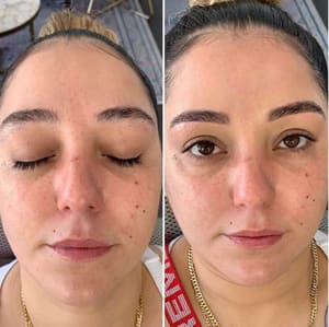 Eyeliner Tattoo result by Laturca Beauty and Skin Care in West Hollywood, CA