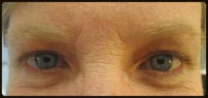 Eyeliner Tattoo result by Laura The Brow Queen in Dallas, TX
